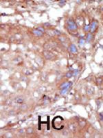 PAB3416 - TNK2 / ACK1