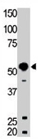 PAB3417 - BLK