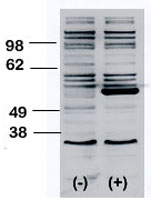 PAB3417 - BLK