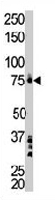 PAB3419 - BTK