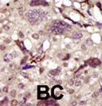PAB3419 - BTK