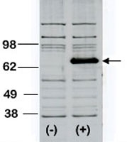 PAB3419 - BTK