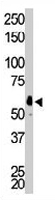 PAB3425 - FGR / SRC2