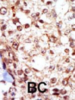PAB3425 - FGR / SRC2