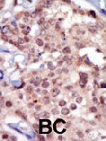 PAB3426 - FRK / PTK5
