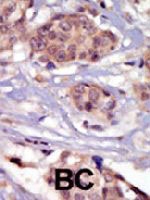 PAB3427 - FYN