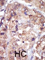 PAB3431 - LYN