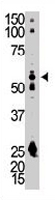 PAB3435 - SRC1