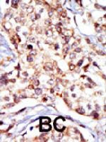 PAB3435 - SRC1