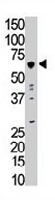 PAB3436 - SRMS