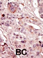 PAB3437 - SRMS