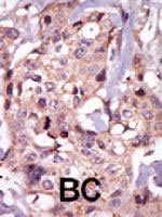 PAB3439 - TEC