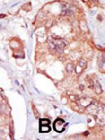 PAB3441 - TNK1