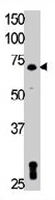 PAB3442 - TXK / PTK4