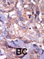 PAB3442 - TXK / PTK4