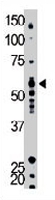 PAB3445 - YES1