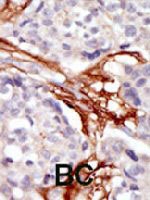 PAB3445 - YES1