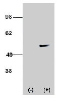 PAB3449 - STK38L