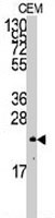PAB3461 - NRAS