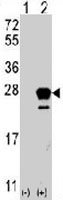 PAB3461 - NRAS
