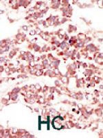 PAB3464 - PTK7 / CCK4