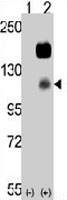 PAB3464 - PTK7 / CCK4