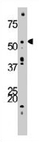 PAB3465 - Activin receptor type 1B / ACVR1B