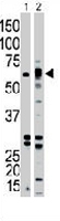 PAB3467 - Activin receptor type 1B / ACVR1B