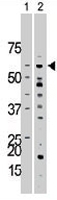 PAB3474 - Activin receptor type 1 / ACRV1