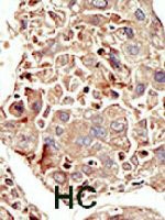 PAB3474 - Activin receptor type 1 / ACRV1