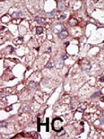 PAB3475 - ACVRL1 / ALK1