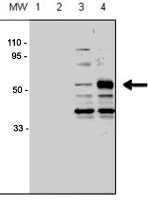PAB3475 - ACVRL1 / ALK1