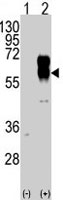 PAB3475 - ACVRL1 / ALK1