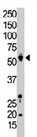 PAB3476 - ACVRL1 / ALK1