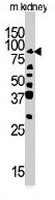 PAB3477 - RIPK4