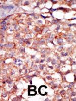 PAB3477 - RIPK4