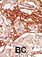PAB3478 - ARAF