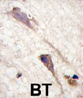 PAB3480 - B-Raf proto-oncogene