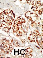 PAB3483 - Kinase suppressor of Ras 1