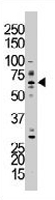 PAB3484 - LIMK1