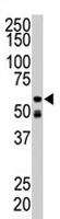 PAB3498 - RIPK2