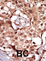 PAB3498 - RIPK2