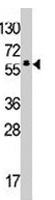 PAB3502 - TESK2