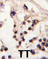 PAB3502 - TESK2