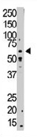 PAB3503 - TGFBR1 / ALK-5