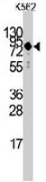 PAB3508 - Transglutaminase-2 (TGM2)