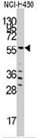 PAB3517 - SARS / SERS