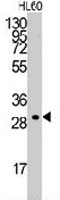 PAB3518 - Cyclin C