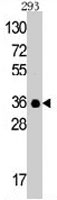 PAB3523 - C1QBP