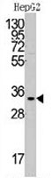 PAB3524 - C1QBP